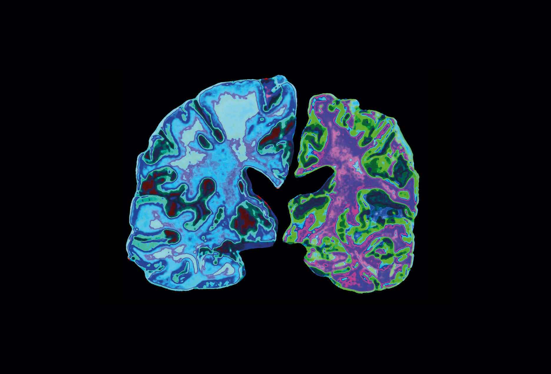 The aging process of humans